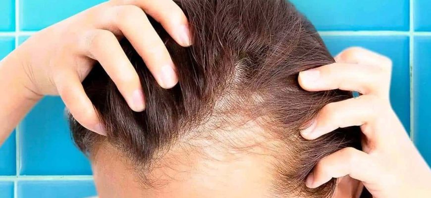 Máscara capilar para estimular o crescimento de cabelo nas áreas mais calvas