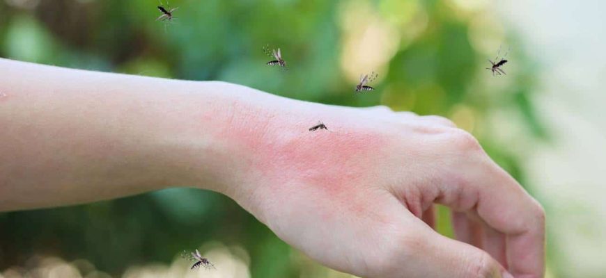 Como aliviar picadas de mosquito? Faça remédios caseiros!